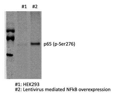 Western Blot: RelA/NFkB p65 [p Ser276] Antibody [NB100-82086]